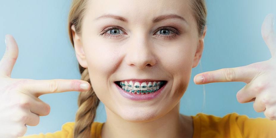 Girl with braces pointing to them and smiling - Smile at the world orthodontics temple Texas