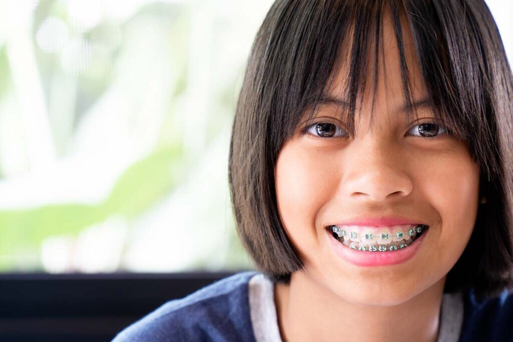 Girl with Braces - Smile at the World Orthodontics Temple Texas